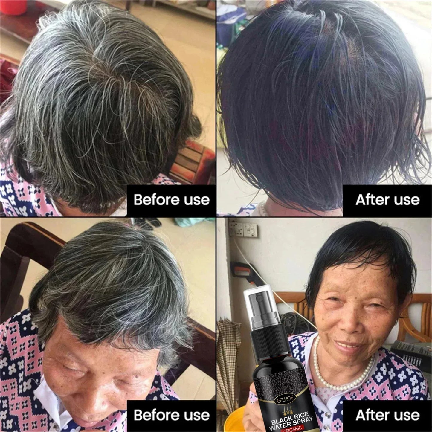 Gray White Hair Treatment Serum Cover White Hair To Black Natural Color Repair Spray Anti Loss Hair Restore Healthy Care