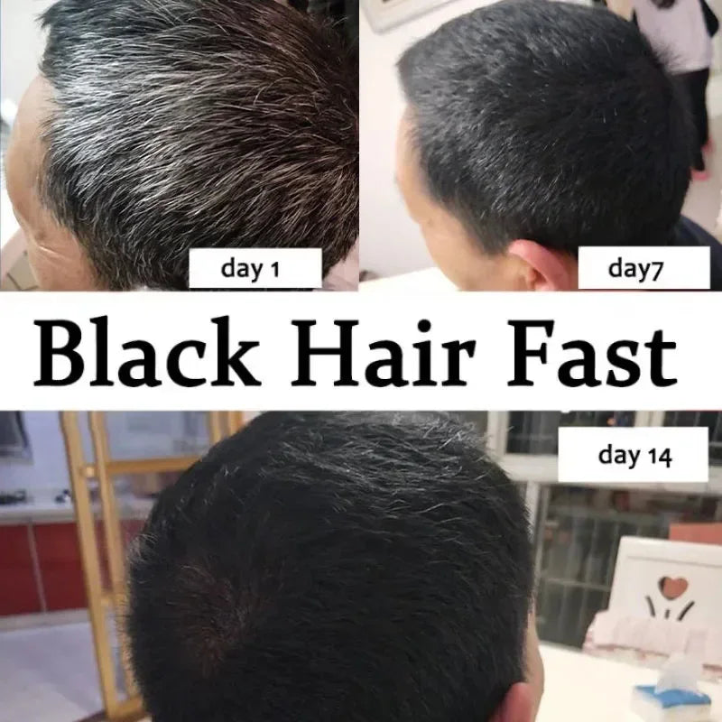Gray White Hair Treatment Serum Cover White Hair To Black Natural Color Repair Spray Anti Loss Hair Restore Healthy Care